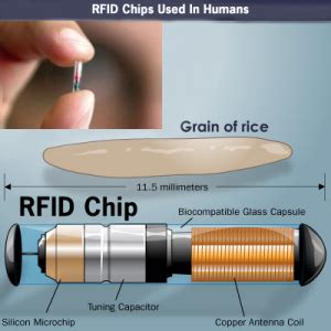 wyoming rfid chip|rfid implantation.